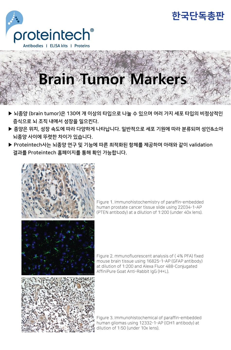 proteintech 뇌종양 마커 항체 소개