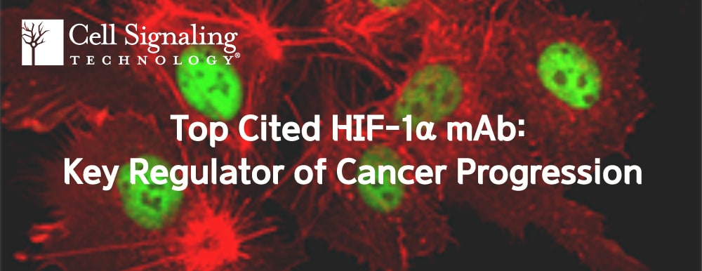 CST Top Cited HIF-1a mAb