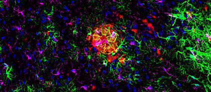 Cell Signaling Technology Neurodegeneration